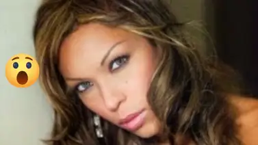 Karina Salaya se realizó doloroso tratamiento estético y así luce Karina Salaya se realizó doloroso tratamiento estético y así luce