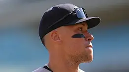 MLB: Aaron Judge le resta importancia a su molestia