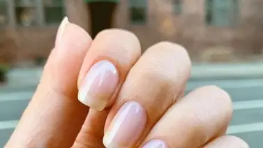 Estos son los consejos para eliminar y tratar las estrías en las uñas (+Detalles) Estos son los consejos para eliminar y tratar las estrías en las uñas (+Detalles)