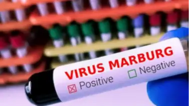 Alerta sanitaria: Precauciones cruciales ante el brote del virus de Marburg en Ruanda Alerta sanitaria: Precauciones cruciales ante el brote del virus de Marburg en Ruanda