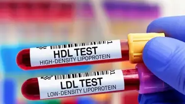 Conoce como medir y prevenir el colesterol alto Conoce como medir y prevenir el colesterol alto