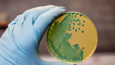 Listeria monocytogenes 