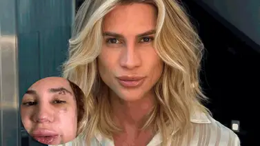 Muere influencer por someterse a una cirugía estética en tendencia Muere influencer por someterse a una cirugía estética en tendencia