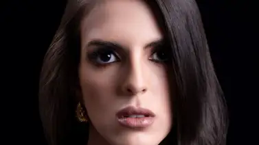 Dra Roslay Hernández nos cuenta sobre los Bioestimuladores de colágeno, la nueva era de la medicina estética Dra Roslay Hernández nos cuenta sobre los Bioestimuladores de colágeno, la nueva era de la medicina estética