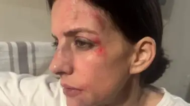 Acusan a cantante venezolano de propinarle una golpiza a su exesposa Acusan a cantante venezolano de propinarle una golpiza a su exesposa