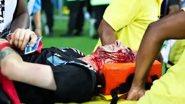 ¡Conmovedor! Así fue el relato de los hinchas argentinos agredidos por la policía brasilera en el Maracaná (+Video) ¡Conmovedor! Así fue el relato de los hinchas argentinos agredidos por la policía brasilera en el Maracaná (+Video)