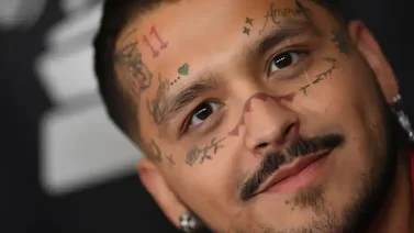 Christian Nodal comparte un adelanto de cómo va la eliminación de los tatuajes 