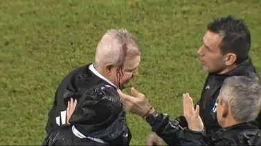 Policía de Honduras tras la pista del agresor de Javier Aguirre (+Video) Policía de Honduras tras la pista del agresor de Javier Aguirre (+Video)