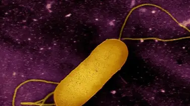 Brote de listeria en California cobra la vida de un bebé y deja 11 afectados Brote de listeria en California cobra la vida de un bebé y deja 11 afectados