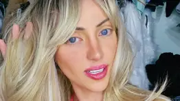 Muere la 'Barbie humana', Bárbara Jankavski a los 31 años en circunstancias sospechosas