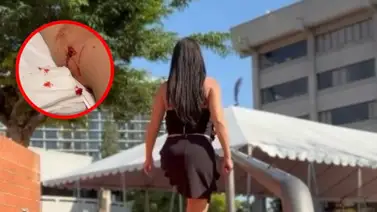 Presentadora mexicana es gravemente atacada por un perro: “Mi pierna está destrozada” Presentadora mexicana es gravemente atacada por un perro: “Mi pierna está destrozada”