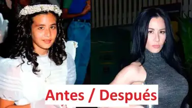 Diosa Canales antes de sus cirugías Diosa Canales antes de sus cirugías