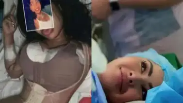 Yailin "La Más Viral" presume los resultados de las cirugías que se realizó  Yailin "La Más Viral" presume los resultados de las cirugías que se realizó