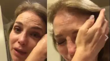 Cirugía estética casi deja desfigurada a la actriz Laura Flores Cirugía estética casi deja desfigurada a la actriz Laura Flores