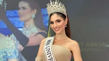El antes y después de Stephany Abasali: el retoquito que inició su transformación  