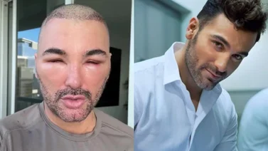 ¿Qué pasó con el rostro del actor Mauricio Mejía?