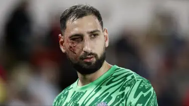 Gianluigi Donnarumma recibe entrada "criminal" en su rostro (+Video) Gianluigi Donnarumma recibe entrada "criminal" en su rostro (+Video)